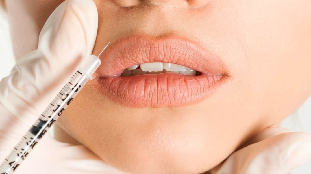 ⁣Sirius Day Spa, Salon & MedSpa : Botox Service in Lakewood Ranch, FL