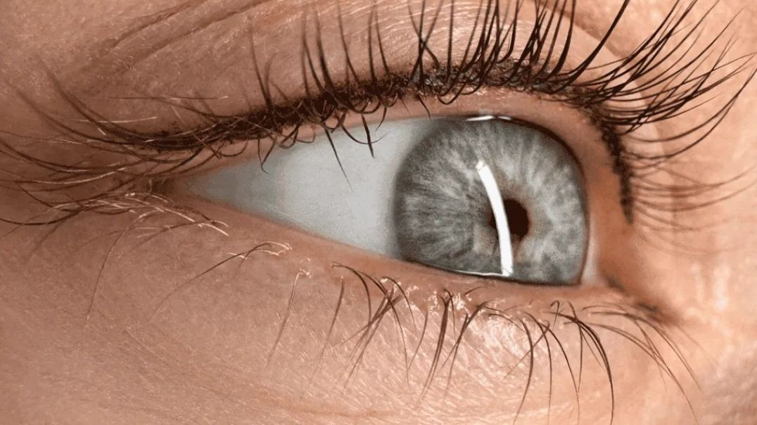 ⁣Belle Ame Skin And Beauty : #1 Permanent Eyeliner in Vancouver, BC