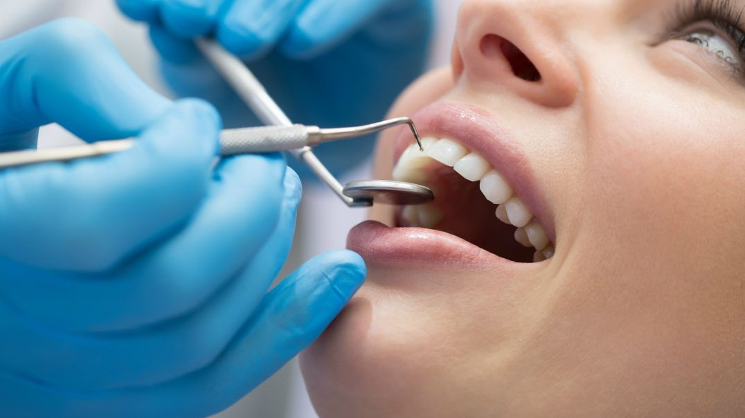 Rielo Dental Clinic : #1 Dental Veneers in Hialeah | 33012