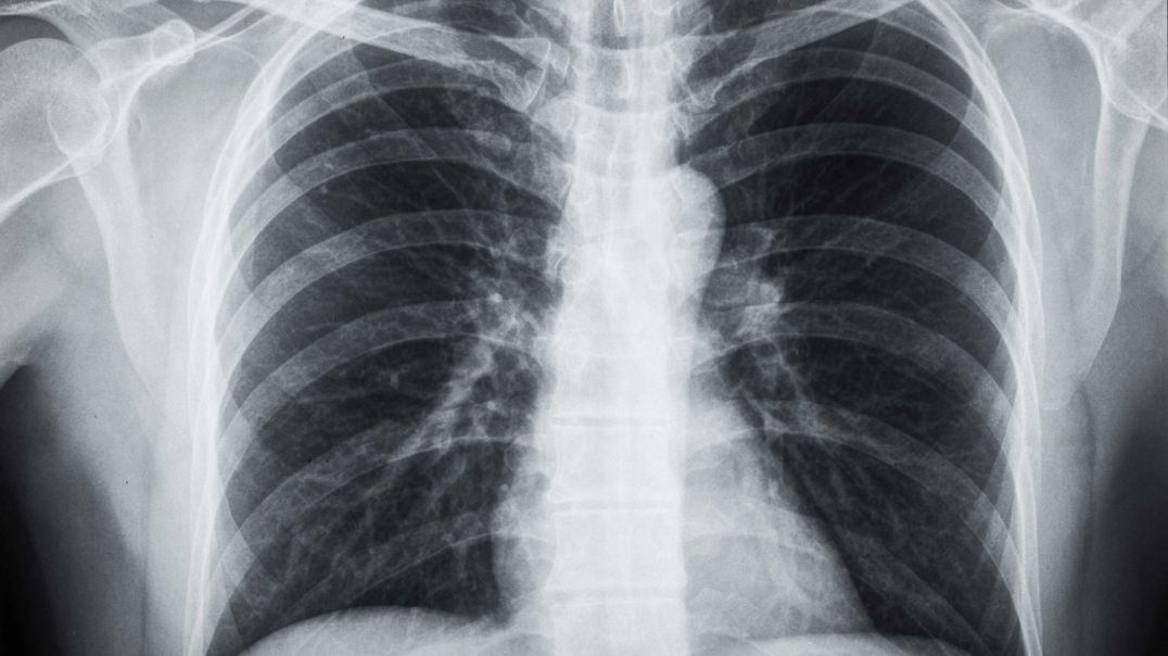 Ultimate Diagnostic Center : #1 Digital Xrays in Homestead, FL